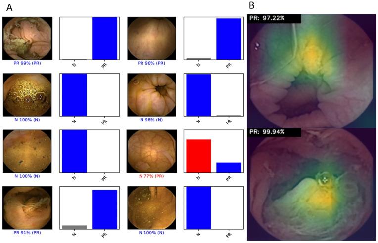 https://cdn.ncbi.nlm.nih.gov/pmc/blobs/1306/9222144/40a4d839adfa/diagnostics-12-01445-g002.jpg