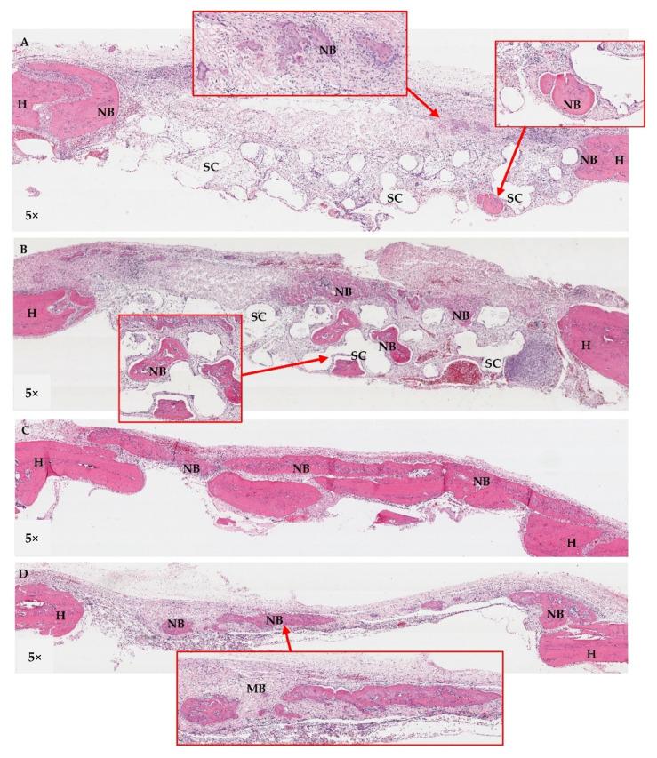https://cdn.ncbi.nlm.nih.gov/pmc/blobs/130c/9326540/e8b53e1af144/jfb-13-00093-g018.jpg