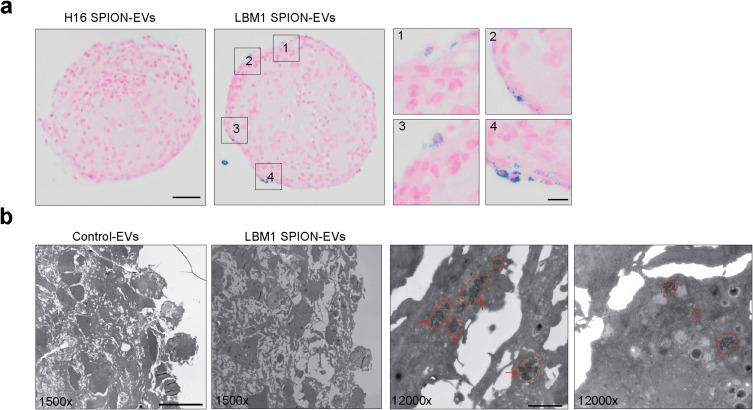 https://cdn.ncbi.nlm.nih.gov/pmc/blobs/130d/12174924/33179911f48c/IJN-20-7501-g0003.jpg