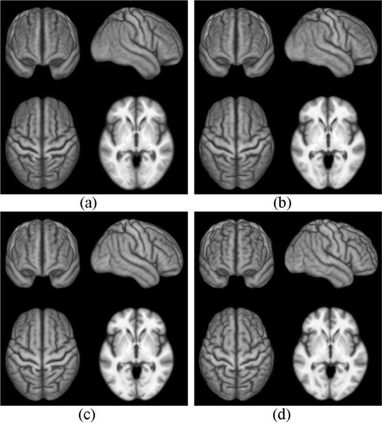 https://cdn.ncbi.nlm.nih.gov/pmc/blobs/130e/6722141/e8690a8c8463/41598_2019_48491_Fig11_HTML.jpg