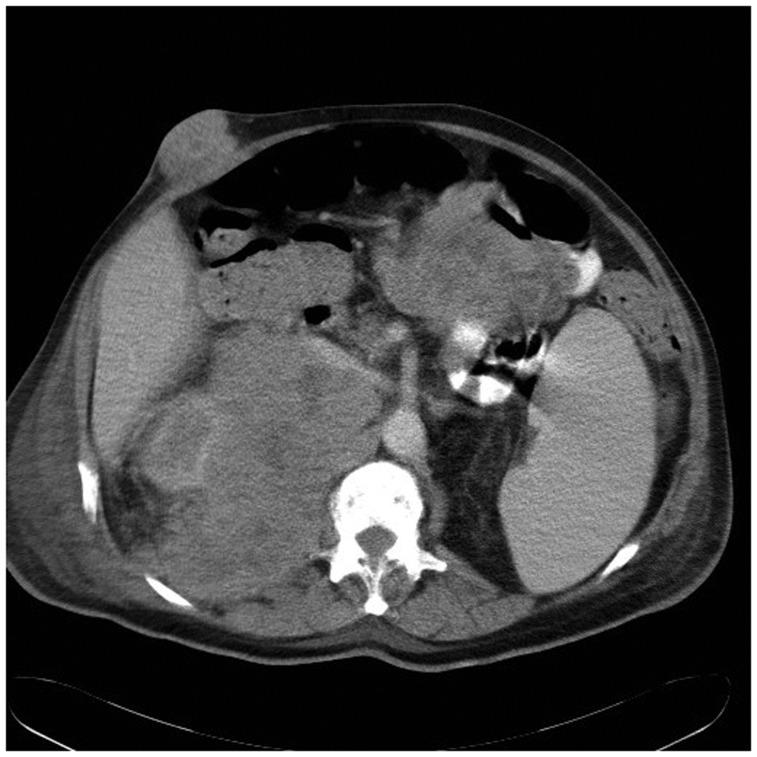 https://cdn.ncbi.nlm.nih.gov/pmc/blobs/1312/5433554/bac1d54dea2f/10.1177_2058460117700449-fig2.jpg