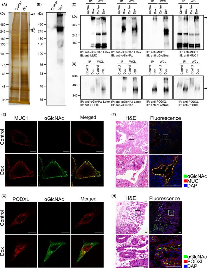 https://cdn.ncbi.nlm.nih.gov/pmc/blobs/1315/9633294/b5e5c89c8e06/CAS-113-3852-g006.jpg