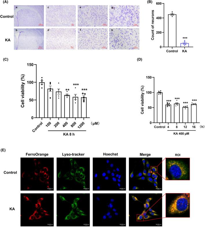 https://cdn.ncbi.nlm.nih.gov/pmc/blobs/131a/11416743/11558e622f72/CNS-30-e70054-g007.jpg
