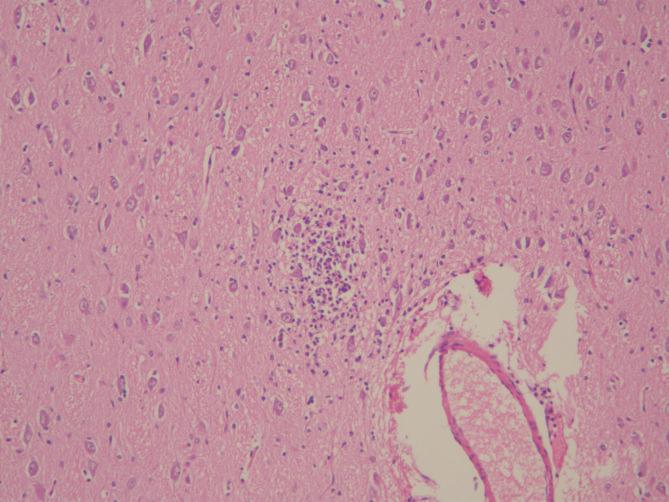 https://cdn.ncbi.nlm.nih.gov/pmc/blobs/1321/7118459/1ebdfb68bdc4/gr5_lrg.jpg