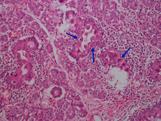 https://cdn.ncbi.nlm.nih.gov/pmc/blobs/1321/7118459/39bd3f51fcdb/gr1_lrg.jpg