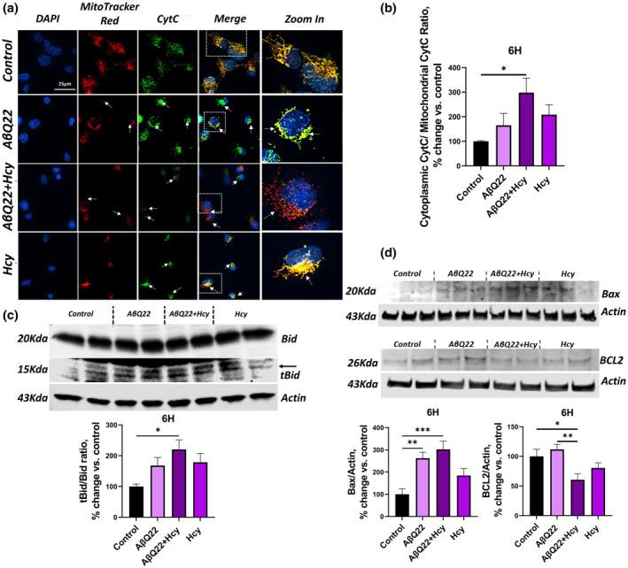 https://cdn.ncbi.nlm.nih.gov/pmc/blobs/1325/11113365/8e705b86c912/ACEL-23-e14106-g001.jpg