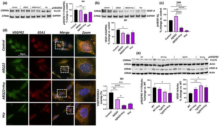 https://cdn.ncbi.nlm.nih.gov/pmc/blobs/1325/11113365/bde5131499ed/ACEL-23-e14106-g007.jpg