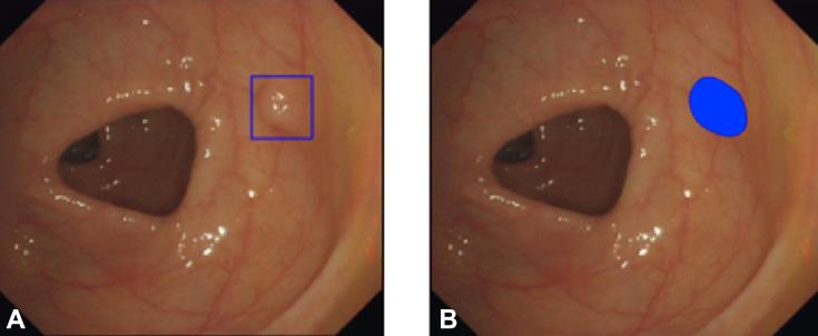 https://cdn.ncbi.nlm.nih.gov/pmc/blobs/132e/7125397/ca26ff006bc1/gr2.jpg