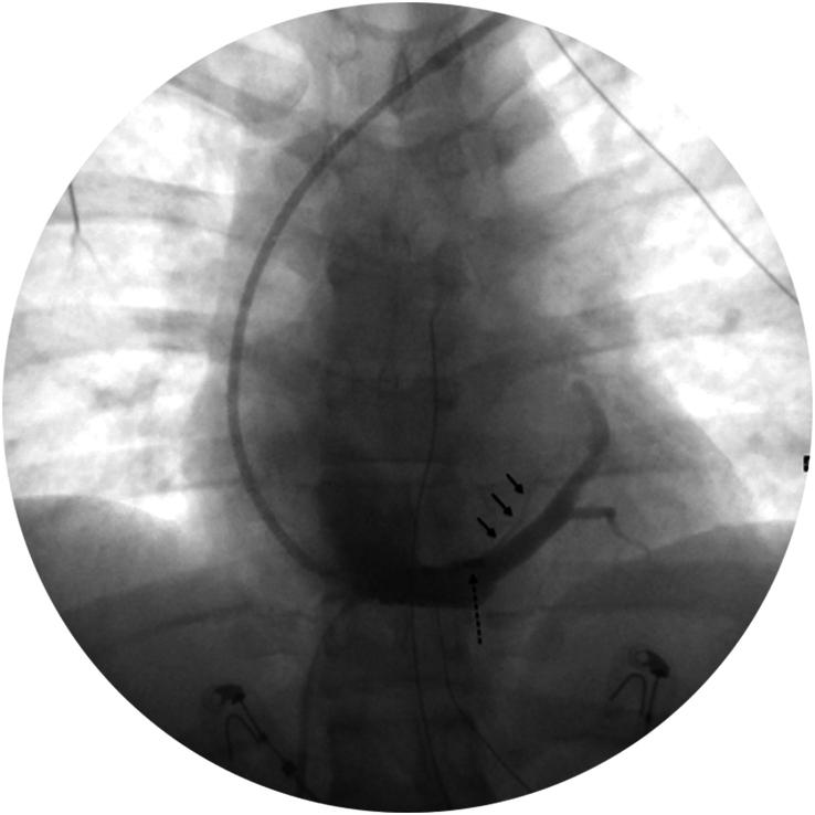 https://cdn.ncbi.nlm.nih.gov/pmc/blobs/1331/11374250/39e0d1d0471c/ms9-86-5648-g003.jpg