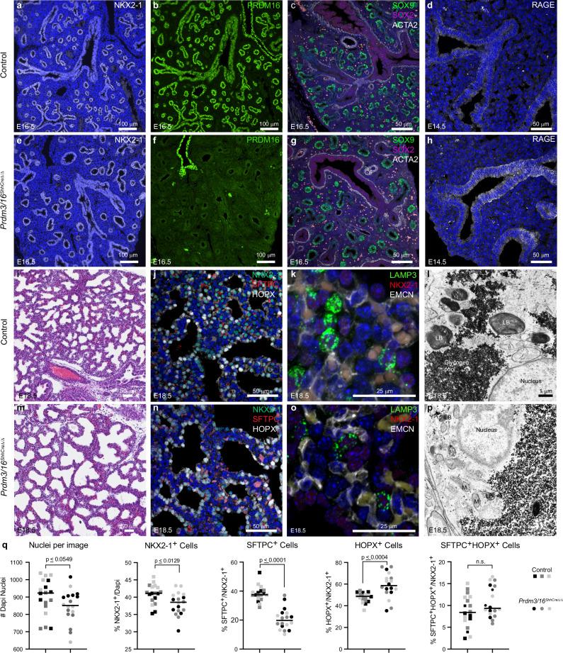 https://cdn.ncbi.nlm.nih.gov/pmc/blobs/1334/11405758/3858c4d69310/41467_2024_52154_Fig1_HTML.jpg