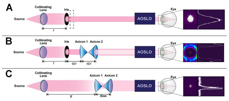 https://cdn.ncbi.nlm.nih.gov/pmc/blobs/1337/12339292/1b05679ed075/boe-16-8-3172-g004.jpg