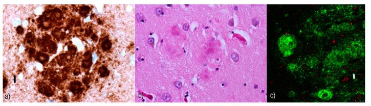 https://cdn.ncbi.nlm.nih.gov/pmc/blobs/1341/7792617/68a588a2353d/ijms-22-00007-g006.jpg