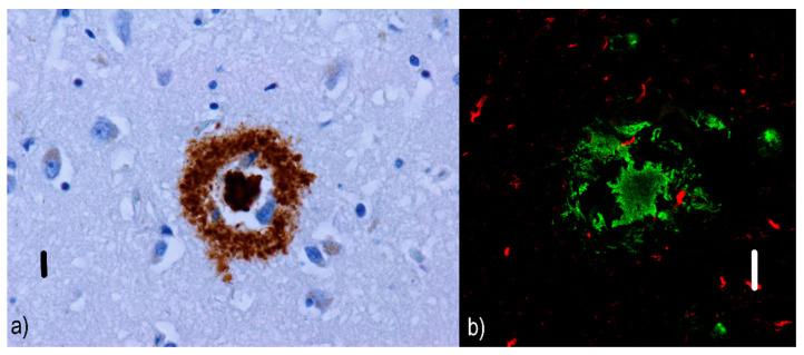 https://cdn.ncbi.nlm.nih.gov/pmc/blobs/1341/7792617/83c6f78db03f/ijms-22-00007-g003.jpg