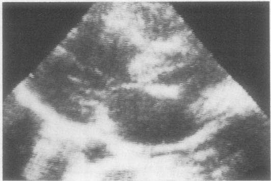 https://cdn.ncbi.nlm.nih.gov/pmc/blobs/134a/459513/2bca5ae57f3b/thorax00207-0010-a.jpg