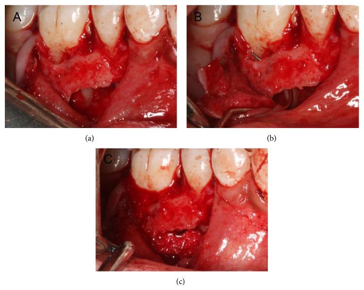 https://cdn.ncbi.nlm.nih.gov/pmc/blobs/1353/4283423/1c82ec0302e1/CRID2014-879562.003.jpg