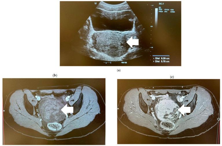https://cdn.ncbi.nlm.nih.gov/pmc/blobs/1359/11433753/a12cd5ba72a1/medicina-60-01477-g001.jpg