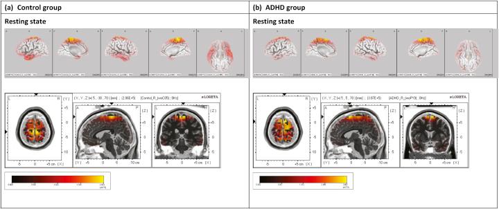 https://cdn.ncbi.nlm.nih.gov/pmc/blobs/135b/6989780/83eceaf72577/gr4.jpg
