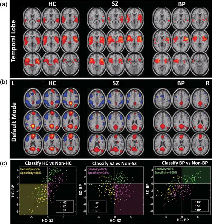 https://cdn.ncbi.nlm.nih.gov/pmc/blobs/135f/7375108/0784306b1df5/HBM-41-3468-g009.jpg
