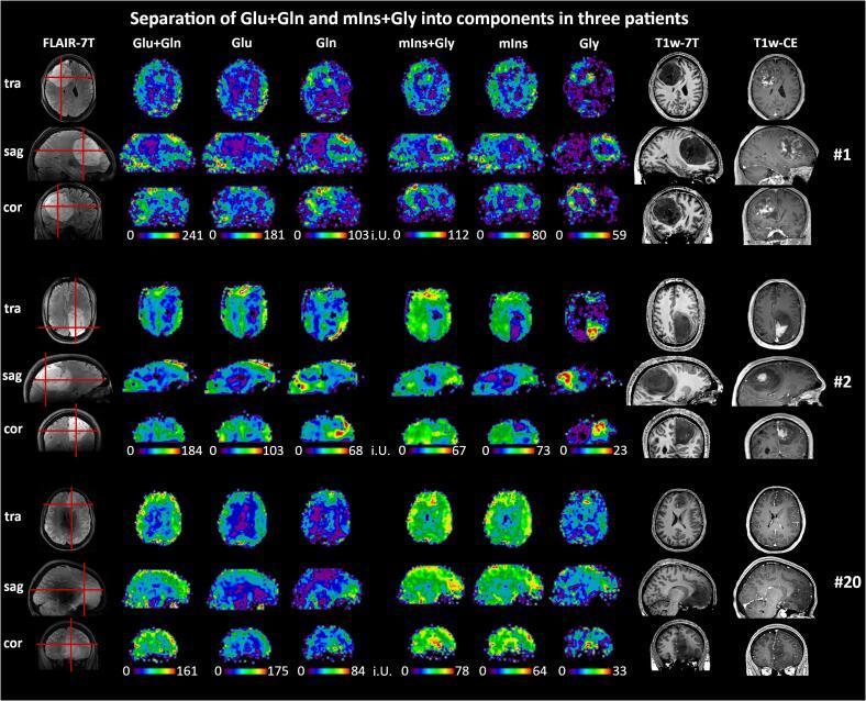 https://cdn.ncbi.nlm.nih.gov/pmc/blobs/1363/7511769/a47cf3e713d8/gr6.jpg