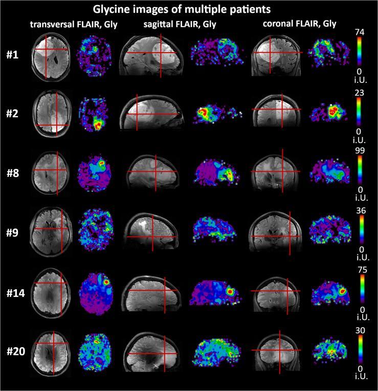 https://cdn.ncbi.nlm.nih.gov/pmc/blobs/1363/7511769/f3afb69d06ae/gr4.jpg