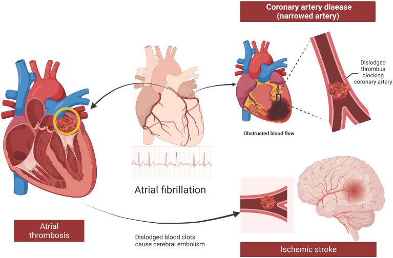 https://cdn.ncbi.nlm.nih.gov/pmc/blobs/136a/11704704/85ace8bce483/ijmsv22p0357g005.jpg