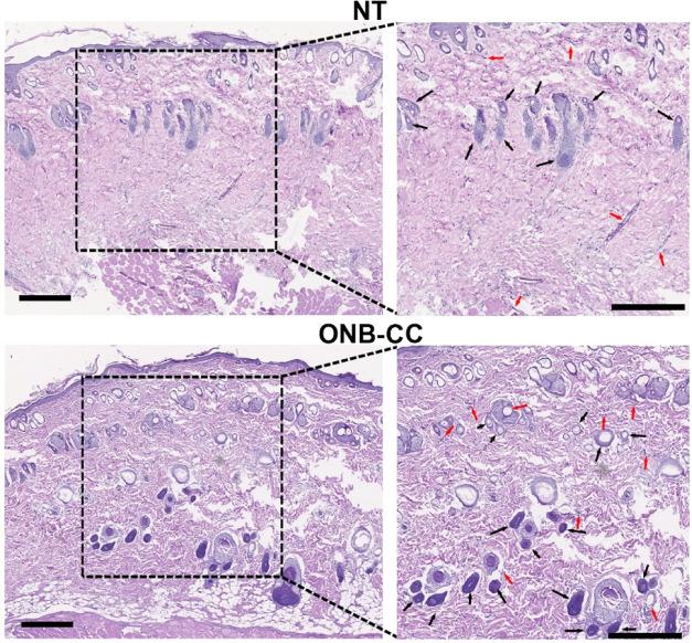 https://cdn.ncbi.nlm.nih.gov/pmc/blobs/136d/11154931/eeec95ed7be0/ao4c03324_0005.jpg