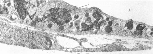 https://cdn.ncbi.nlm.nih.gov/pmc/blobs/136e/1165133/446a4336dd8a/janat00193-0036-c.jpg