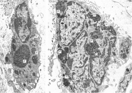 https://cdn.ncbi.nlm.nih.gov/pmc/blobs/136e/1165133/ed916b50a366/janat00193-0038-c.jpg