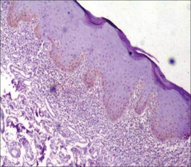 https://cdn.ncbi.nlm.nih.gov/pmc/blobs/1373/4160688/6c8d99006fe8/AMHSR-4-598-g002.jpg
