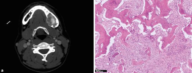 https://cdn.ncbi.nlm.nih.gov/pmc/blobs/1376/10322770/22087748f48f/292_2023_1195_Fig5_HTML.jpg