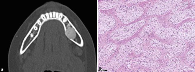 https://cdn.ncbi.nlm.nih.gov/pmc/blobs/1376/10322770/24a5a40bcb71/292_2023_1195_Fig2_HTML.jpg