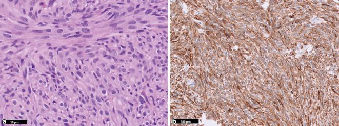 https://cdn.ncbi.nlm.nih.gov/pmc/blobs/1376/10322770/89a085283b07/292_2023_1195_Fig6_HTML.jpg