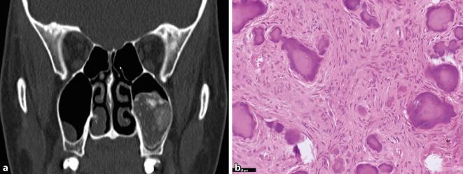 https://cdn.ncbi.nlm.nih.gov/pmc/blobs/1376/10322770/e173c6dd4236/292_2023_1195_Fig1_HTML.jpg