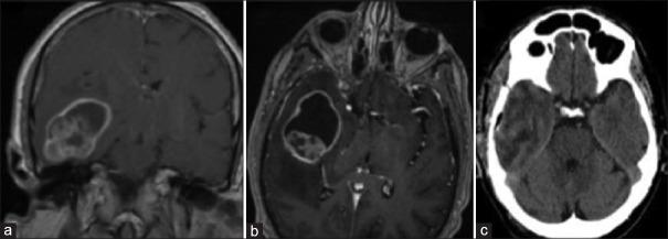 https://cdn.ncbi.nlm.nih.gov/pmc/blobs/1381/12367255/57f21eac1d6d/BC-11-236-g001.jpg