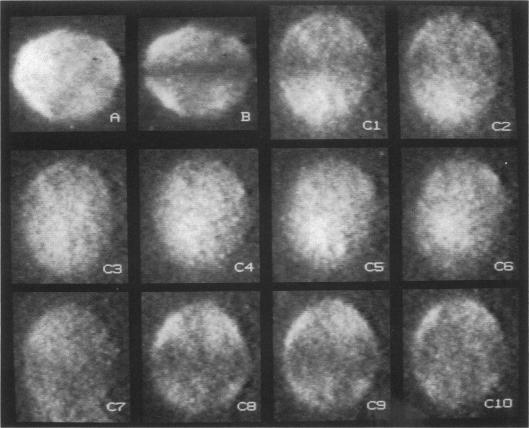 https://cdn.ncbi.nlm.nih.gov/pmc/blobs/1381/1281095/4ef60f75cb6d/biophysj00120-0095-a.jpg