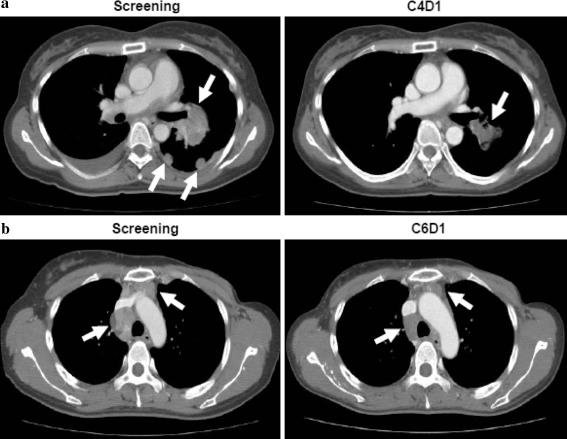 https://cdn.ncbi.nlm.nih.gov/pmc/blobs/1385/3362725/3b040dfebac8/280_2012_1846_Fig1_HTML.jpg