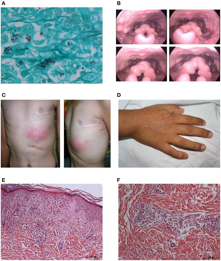 https://cdn.ncbi.nlm.nih.gov/pmc/blobs/1397/5389975/df4254d08f31/fmicb-08-00616-g0001.jpg