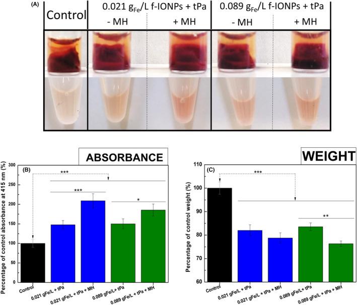 https://cdn.ncbi.nlm.nih.gov/pmc/blobs/139b/9826519/5057d2106f67/JTH-20-2556-g001.jpg