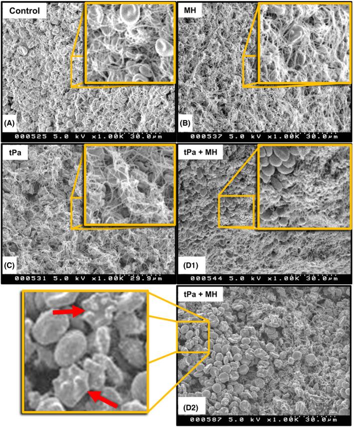 https://cdn.ncbi.nlm.nih.gov/pmc/blobs/139b/9826519/6ce40de4087e/JTH-20-2556-g003.jpg