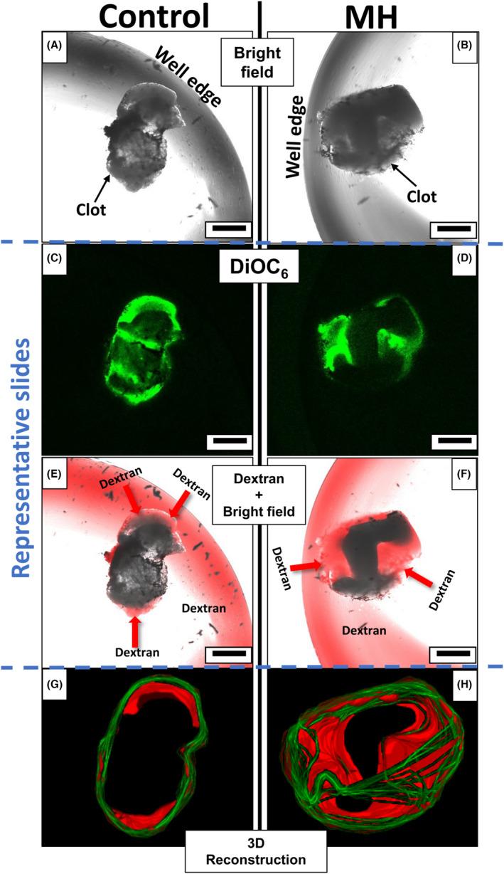 https://cdn.ncbi.nlm.nih.gov/pmc/blobs/139b/9826519/9bcda58d6f44/JTH-20-2556-g004.jpg