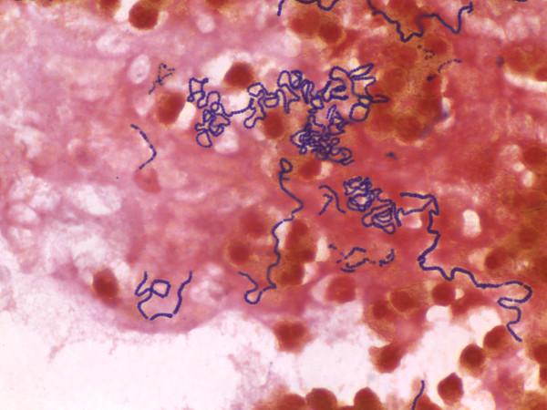 https://cdn.ncbi.nlm.nih.gov/pmc/blobs/13a9/2600825/7ae30f4ecc74/1471-2334-8-154-3.jpg