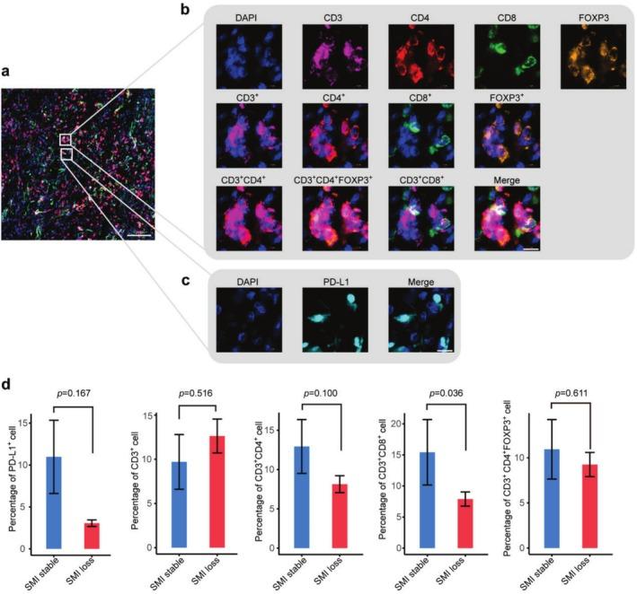 https://cdn.ncbi.nlm.nih.gov/pmc/blobs/13aa/12422944/0d9a20d98f8c/JCSM-16-e70063-g005.jpg