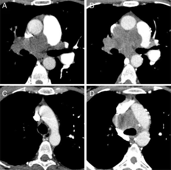 https://cdn.ncbi.nlm.nih.gov/pmc/blobs/13c3/3750466/26ee39242c8b/1471-2342-13-25-1.jpg
