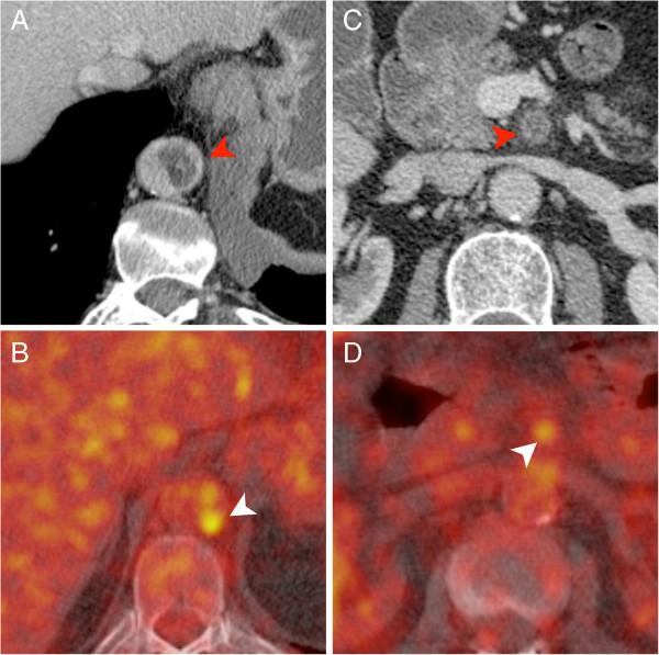https://cdn.ncbi.nlm.nih.gov/pmc/blobs/13c3/3750466/dc20e9e8ec77/1471-2342-13-25-5.jpg