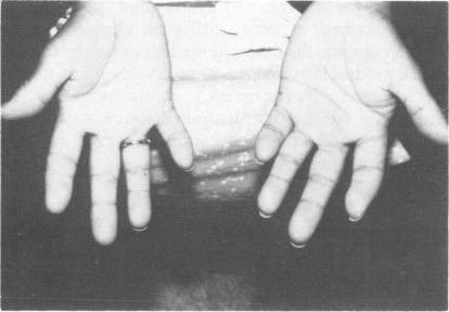 https://cdn.ncbi.nlm.nih.gov/pmc/blobs/13c5/1016903/12598c423e7b/jmedgene00032-0035-a.jpg