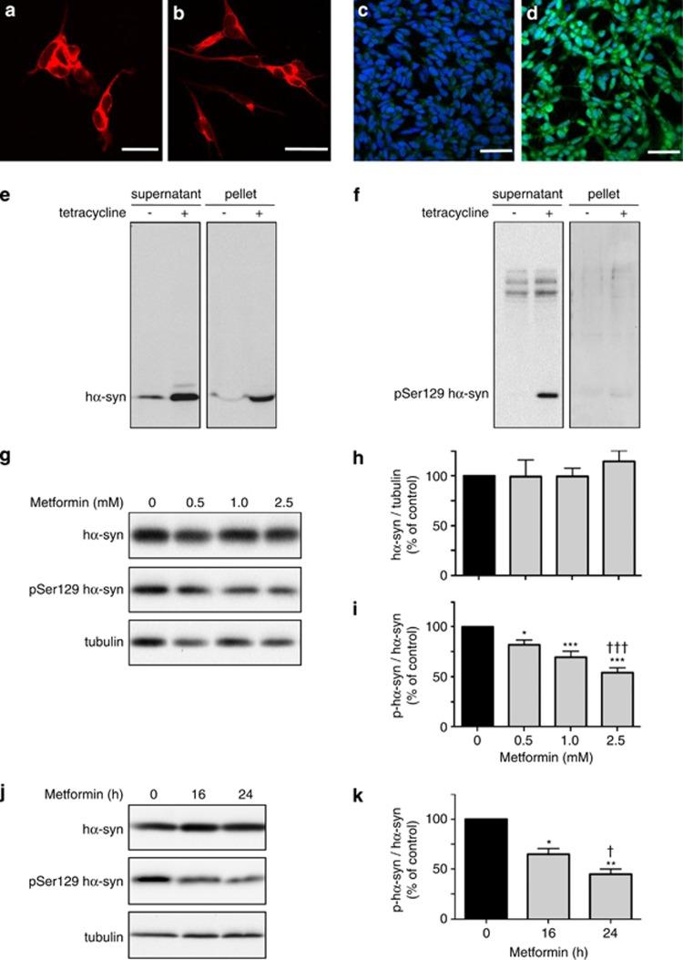 https://cdn.ncbi.nlm.nih.gov/pmc/blobs/13c5/4047877/29eef630cfef/cddis2014175f1.jpg