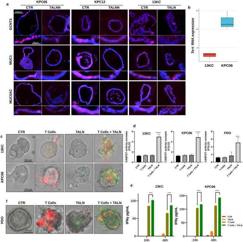 https://cdn.ncbi.nlm.nih.gov/pmc/blobs/13ca/10668479/8c99a637b434/12967_2023_4733_Fig4_HTML.jpg