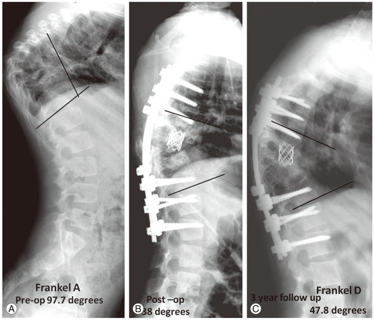https://cdn.ncbi.nlm.nih.gov/pmc/blobs/13cb/4278975/8444f063c862/asj-8-711-g005.jpg