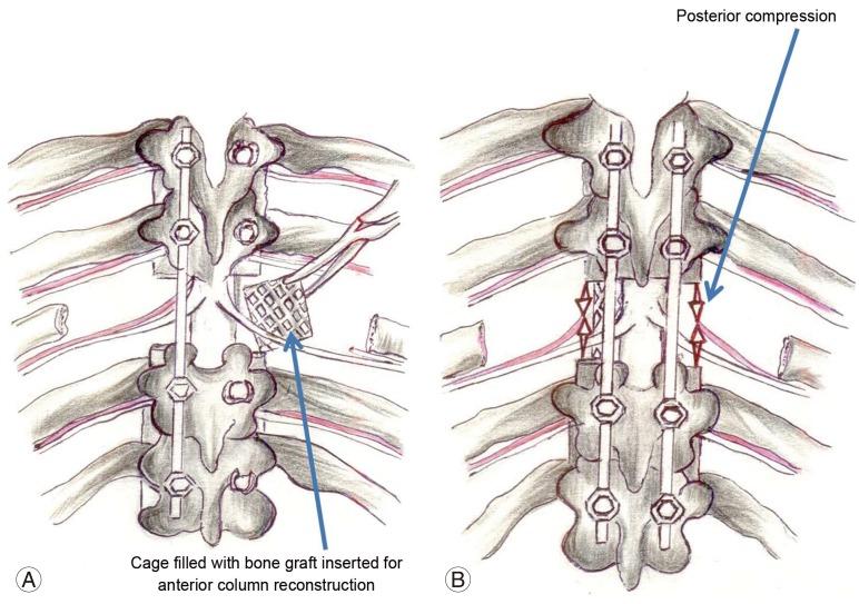 https://cdn.ncbi.nlm.nih.gov/pmc/blobs/13cb/4278975/87155ab4be8e/asj-8-711-g004.jpg
