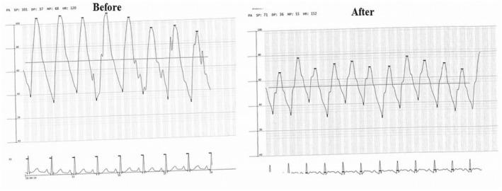 https://cdn.ncbi.nlm.nih.gov/pmc/blobs/13cc/10863355/fc805e7cf0ab/CCR3-12-e8529-g002.jpg